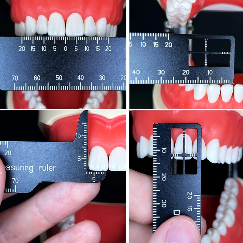 Regla de medición de dientes d - Photography Rules reseña y precio